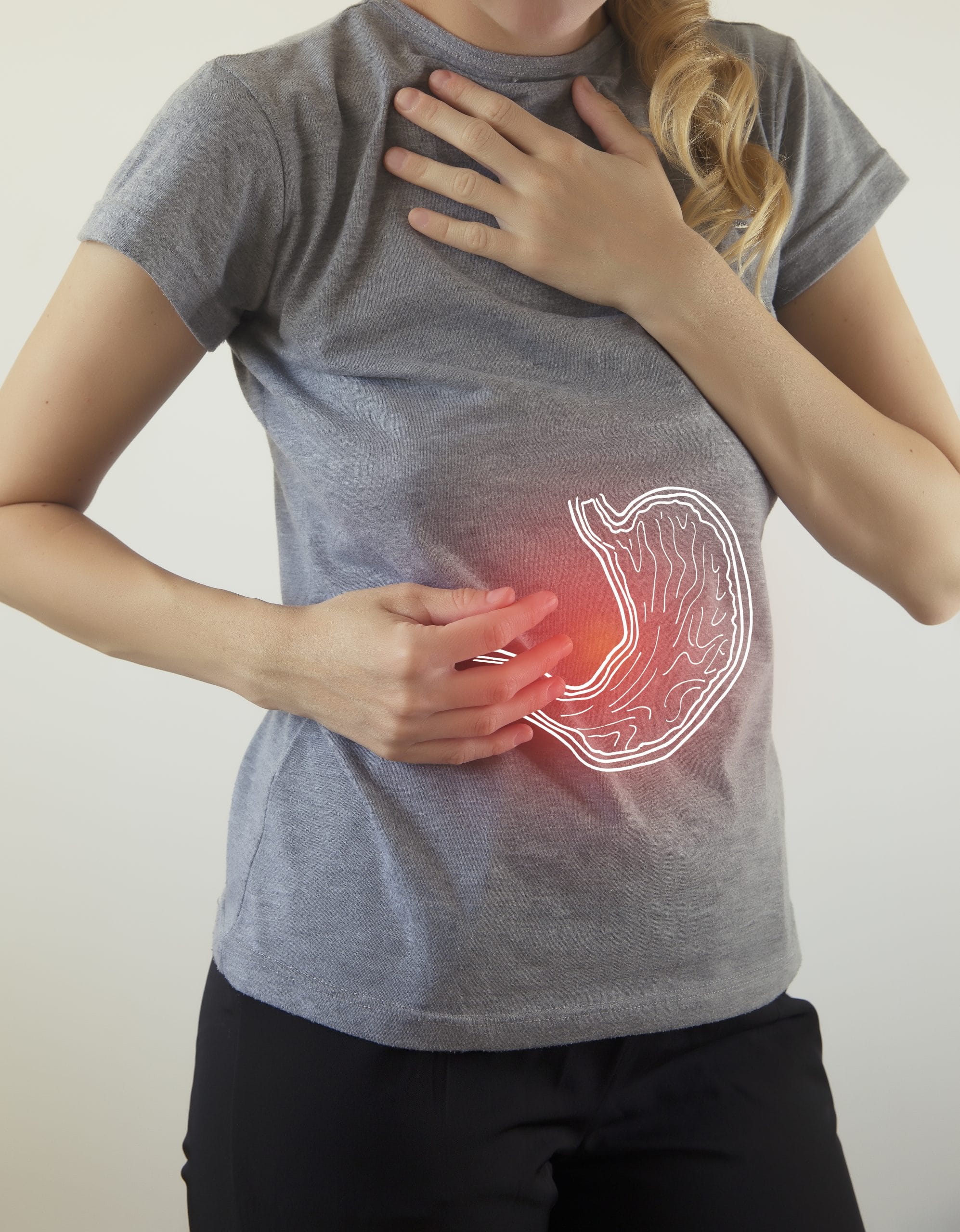 woman suffering from gastritis reflusso e acidità